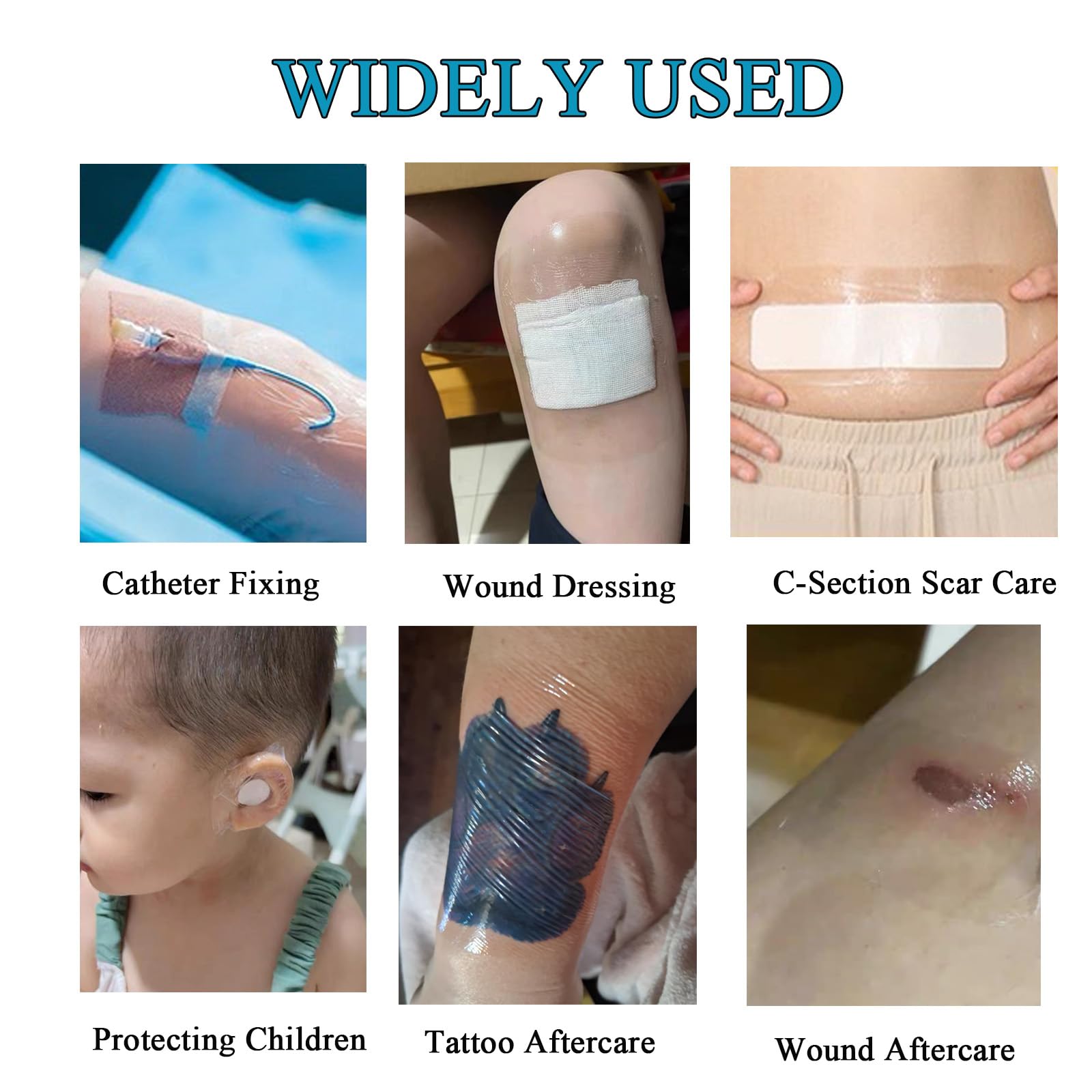 ANAMPION hypoallergenic soft-material bandage minimizes irritation while staying in place.