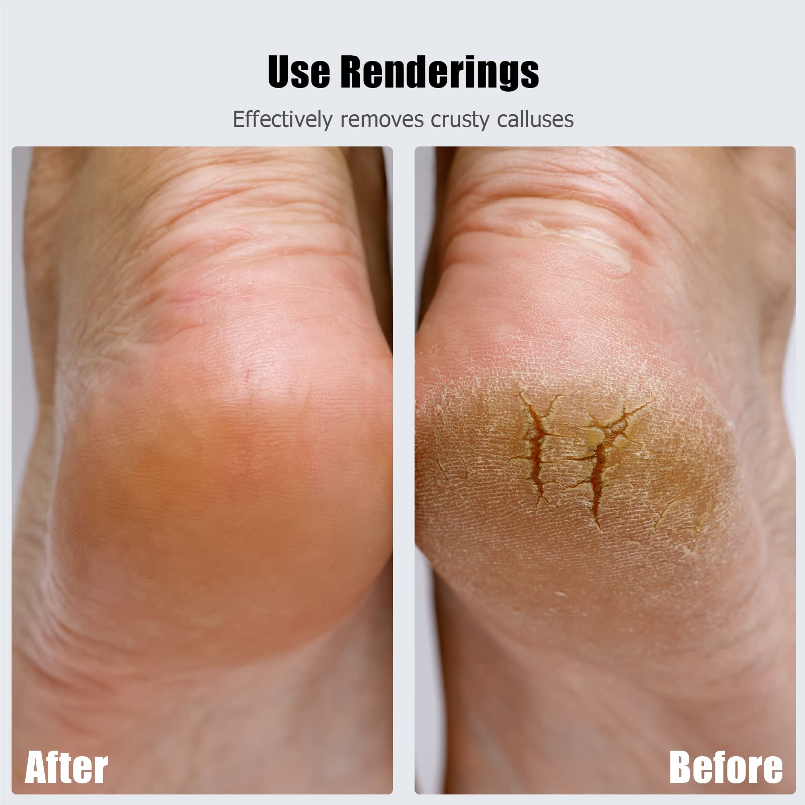 Ancable Flawless Pedi in-use on feet for smoother skin.