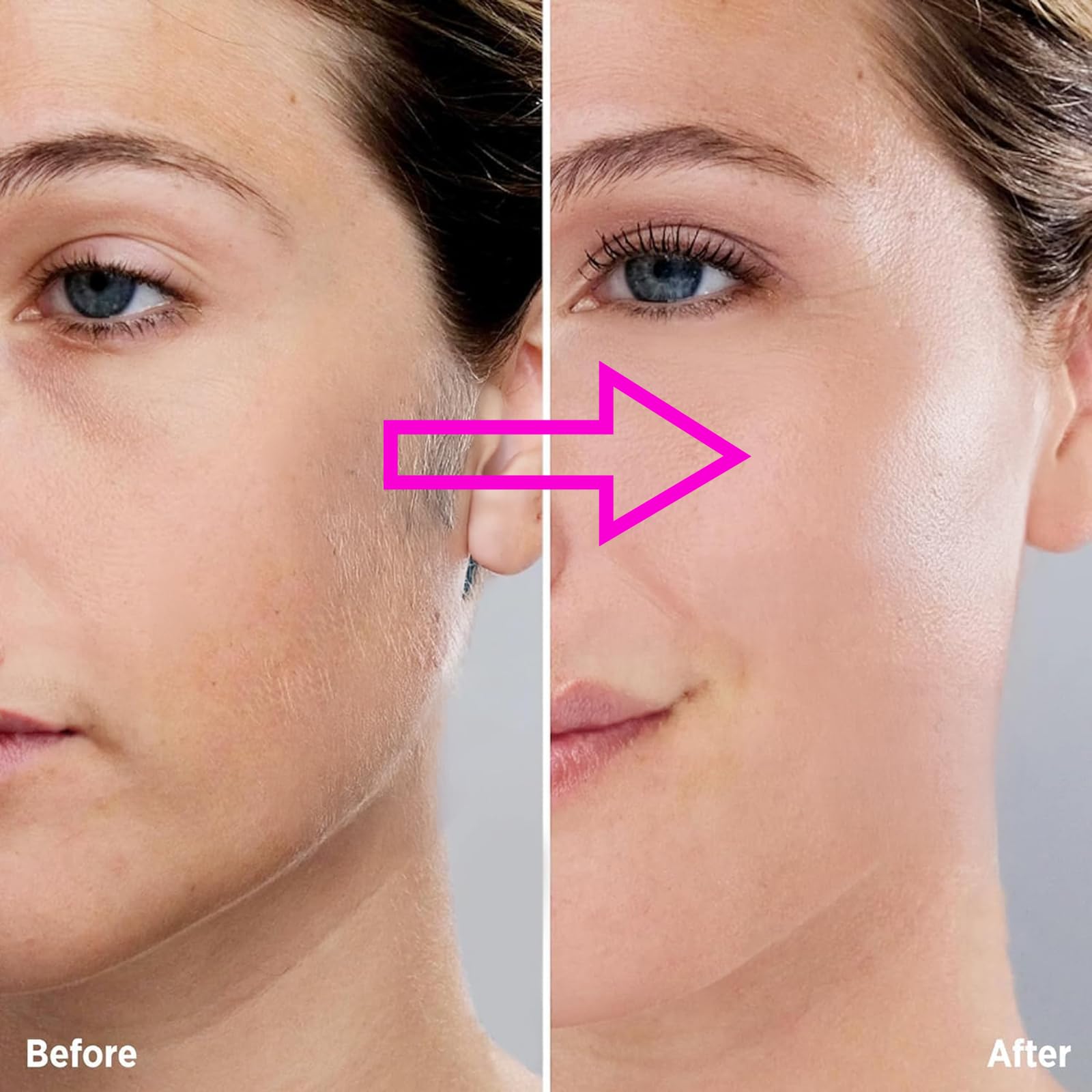 Angel Kiss gen3 hypoallergenic blades deliver gentle peach fuzz removal on sensitive skin.