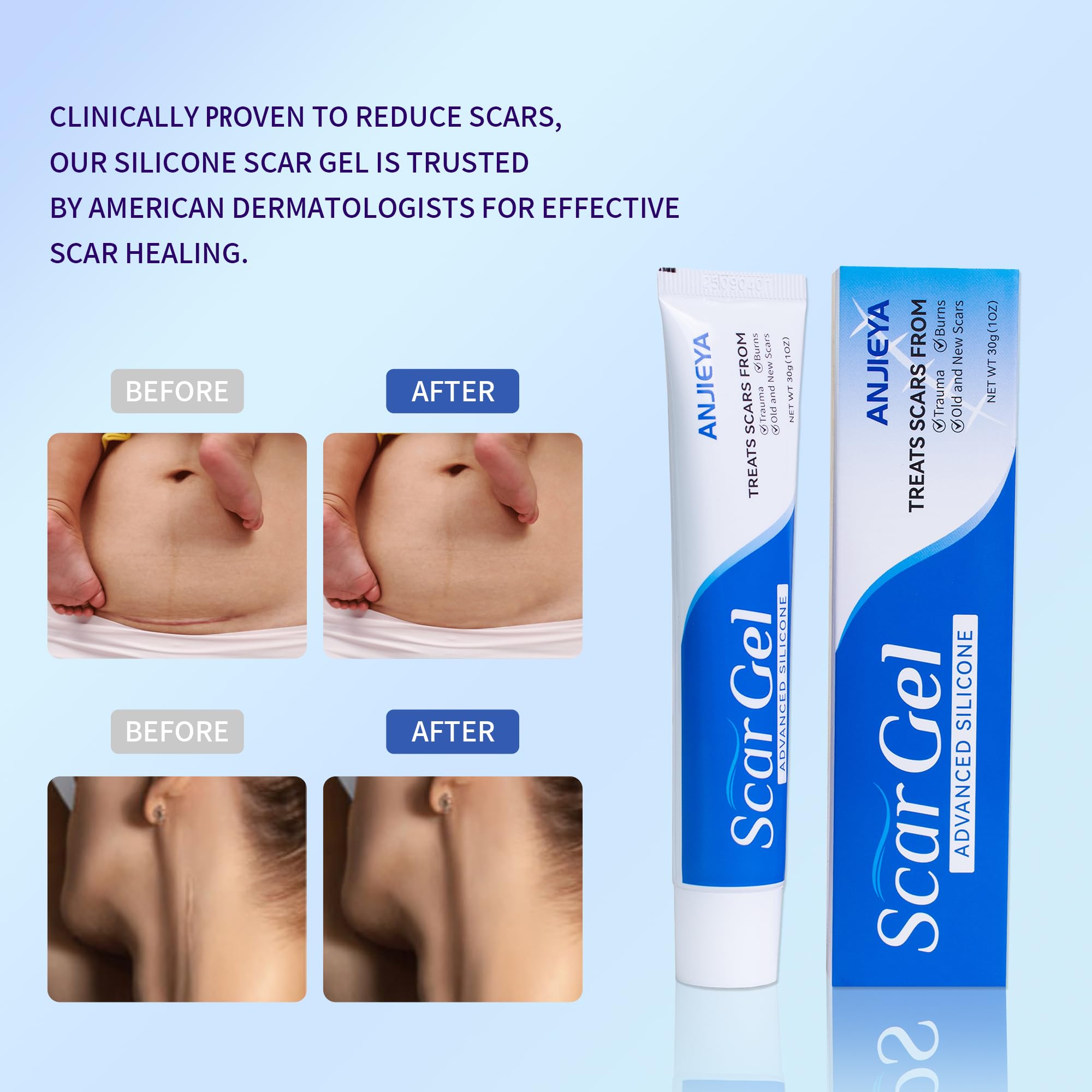 ANJIEYA silicone scar gel texture swatch showing lightweight, non-greasy finish.