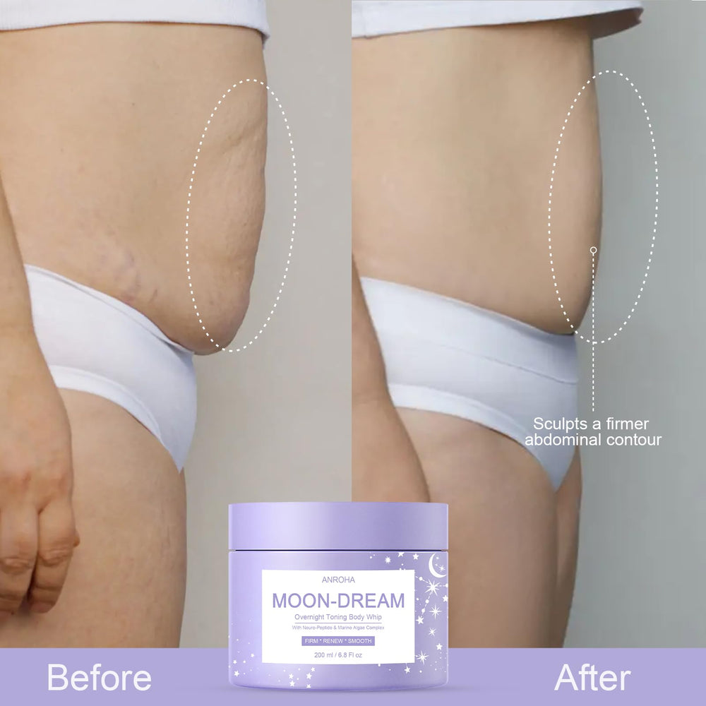 Anroha Moon Dream arm-area application demonstrates targeted use for smoother arm contours