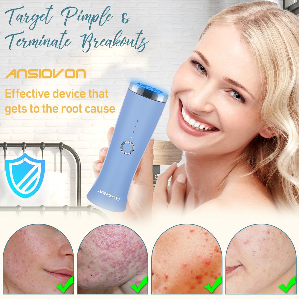 ANSIOVON battery-powered blue light wand offers convenient at-home acne care