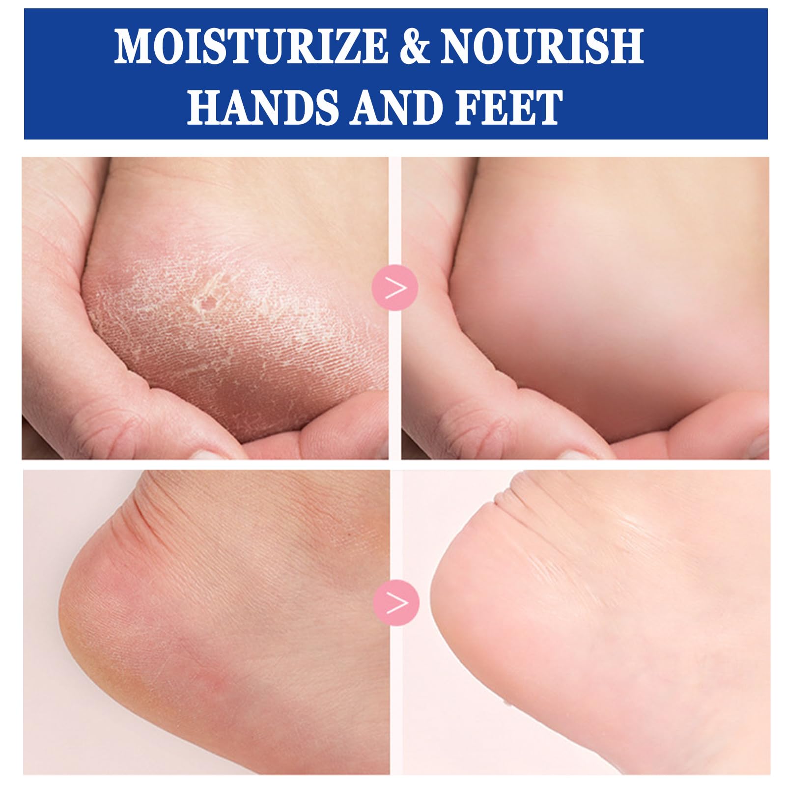 Anweina foot cream non-greasy absorption lets you wear socks immediately.