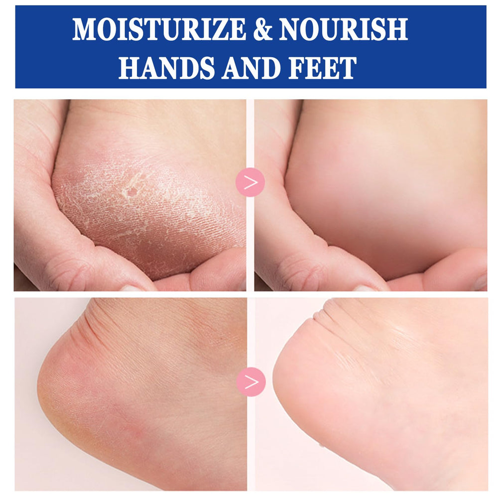 Anweina foot cream non-greasy absorption lets you wear socks immediately.