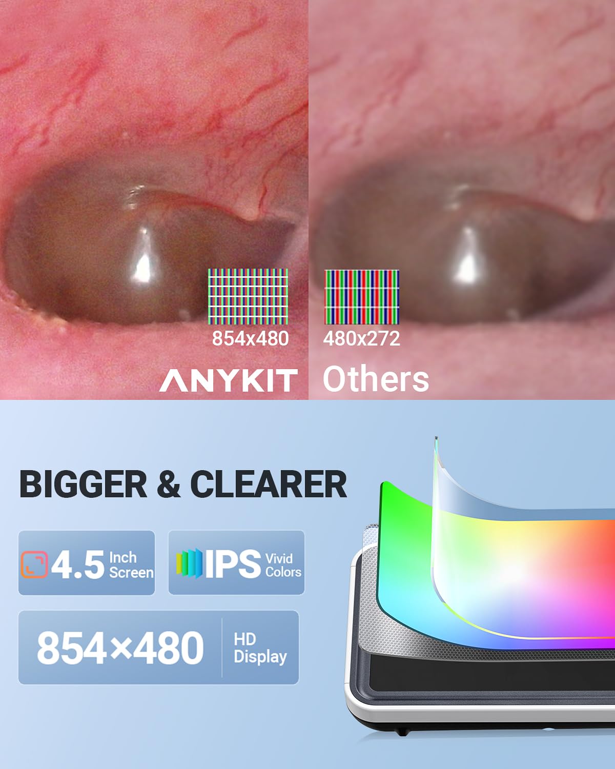 Anykit Digital Otoscope stores photos and videos on a 32GB memory card for quick sharing.