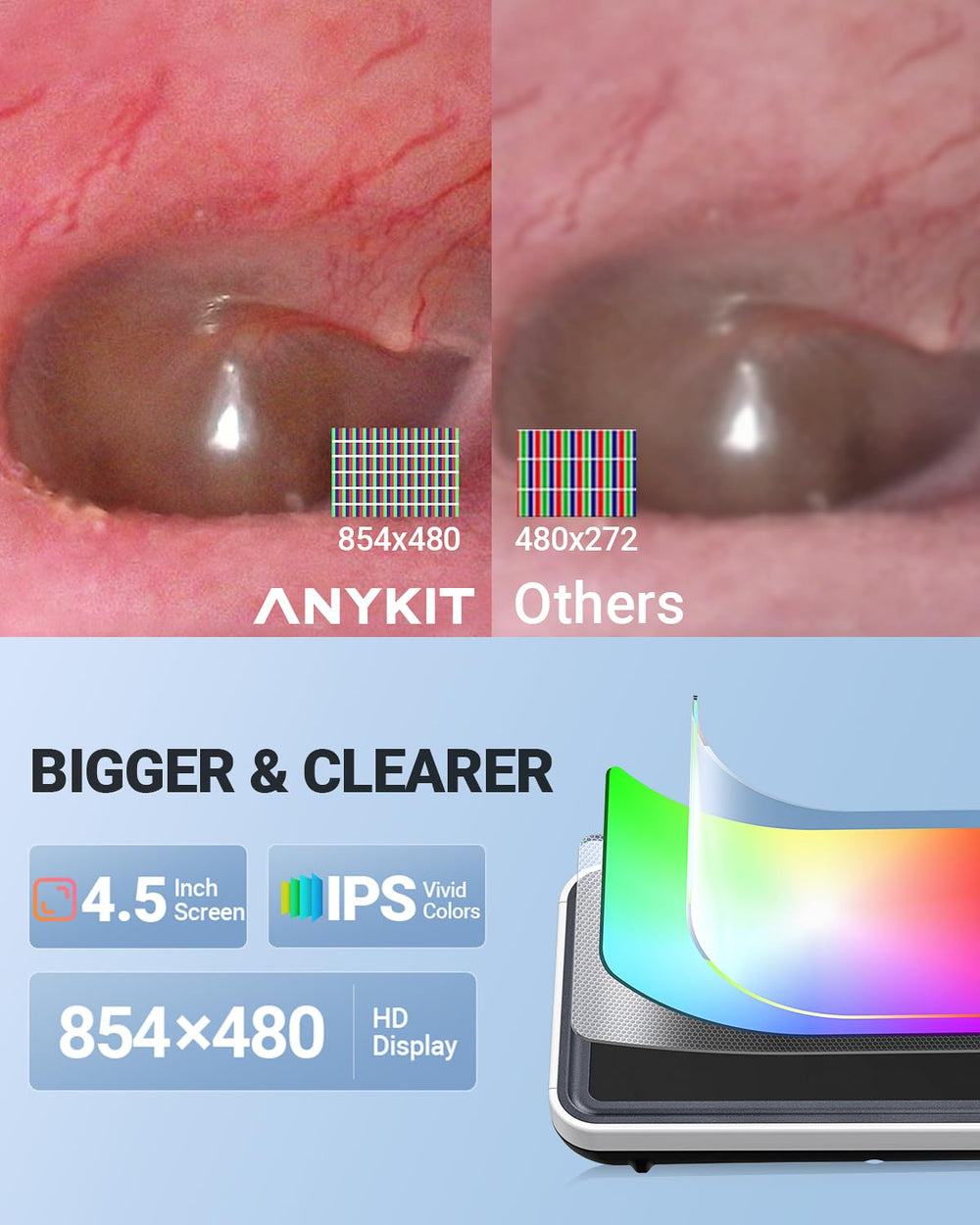 Anykit Digital Otoscope stores photos and videos on a 32GB memory card for quick sharing.