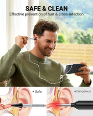Anykit Digital Otoscope camera probe 39mm provides a slim, comfortable insertion view.