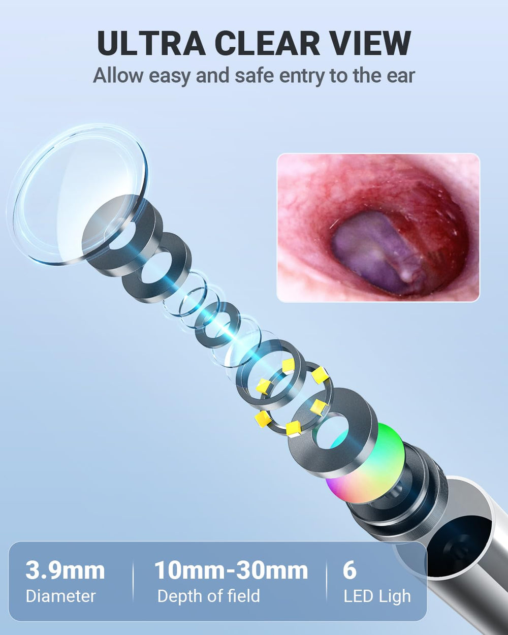 Anykit otoscope includes ear specula for safe, hygienic wax removal.
