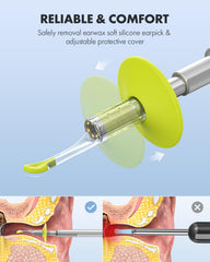 Anykit Otoscope with 6 LED lights offers bright, adjustable illumination for better detail.