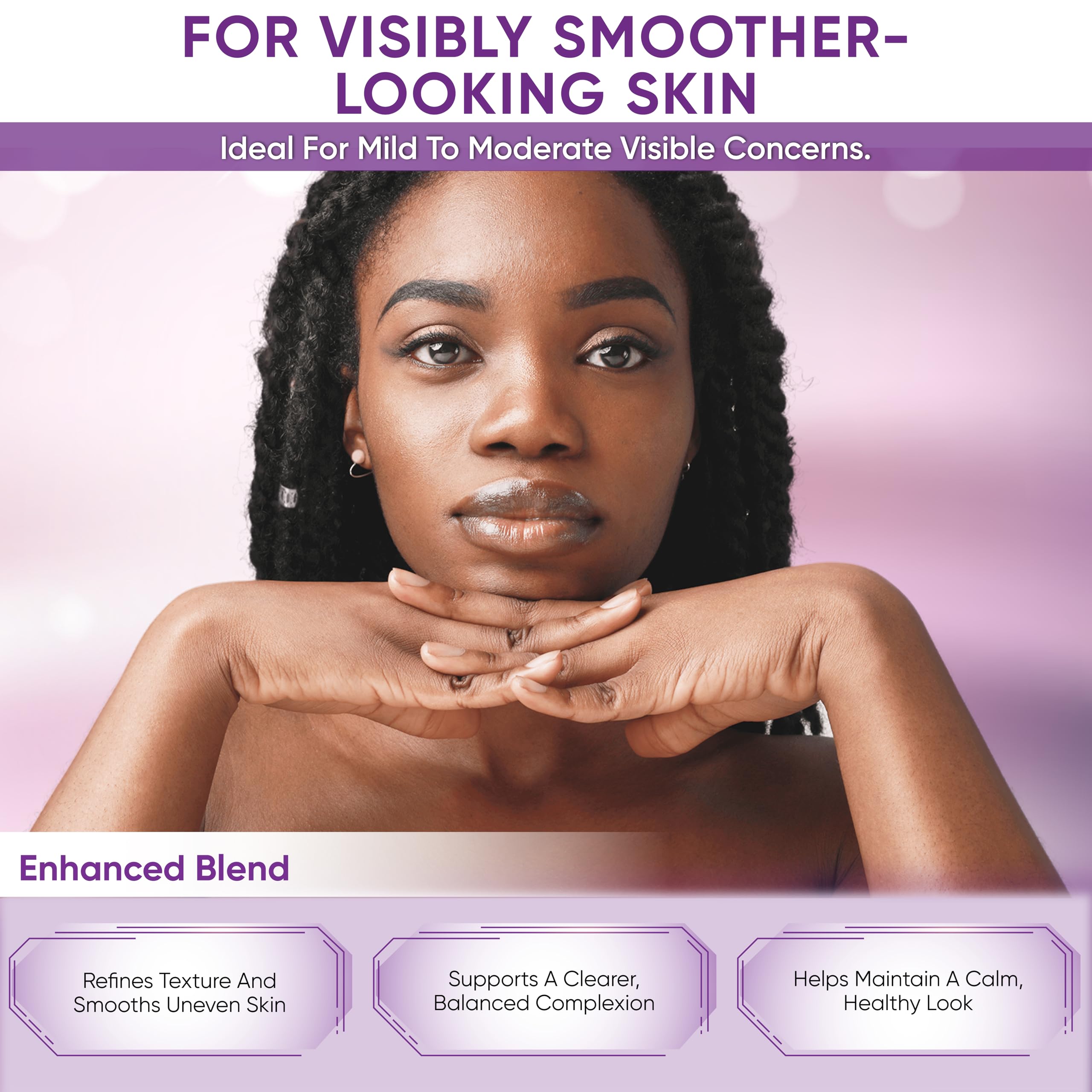 AOBBIY Azelaic Cream on skin suggests a smooth, even look
