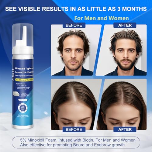 AOOLCF biotin-infused minoxidil foam ingredient highlight for nutrient-rich hair care.