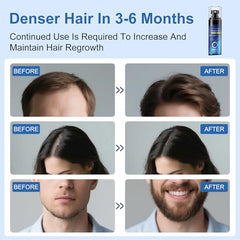 AOOLCF Minoxidil Spray thinning-hair focus promotes thicker appearance and volume.