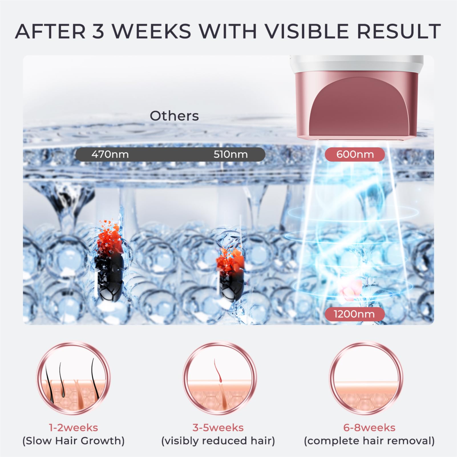Aopvui laser hair removal device energy-levels-9-settings for customization
