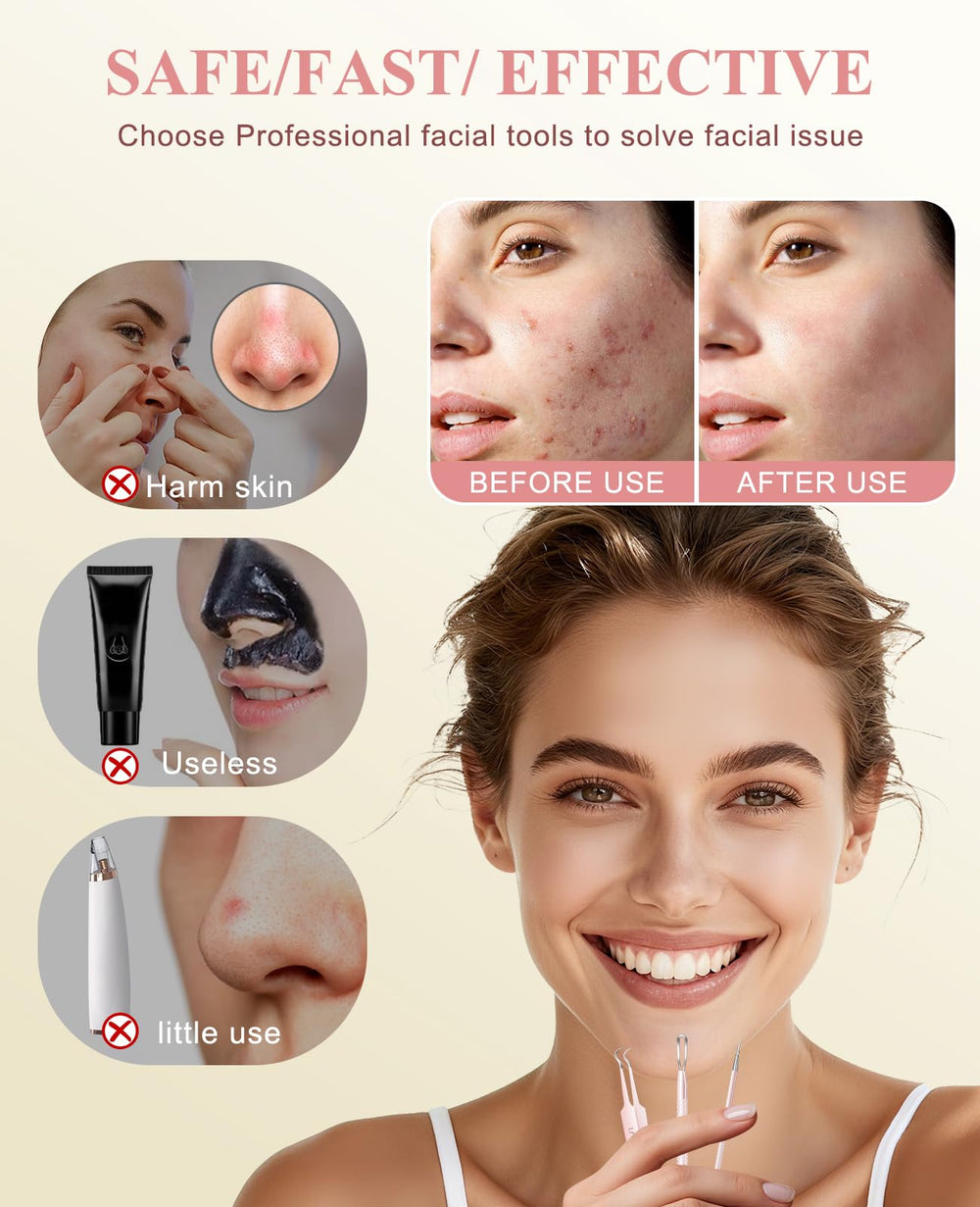 Aosnare compact travel case for pimple extractor enables portable skincare.