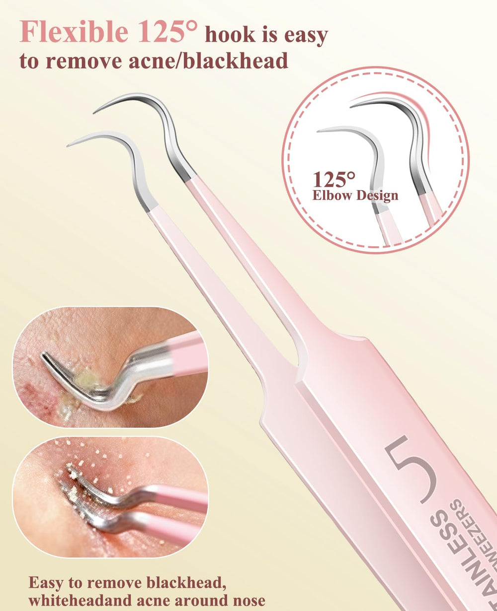 Aosnare pimple extractor tools side angle demonstrates precise blemish removal with medical-grade steel.