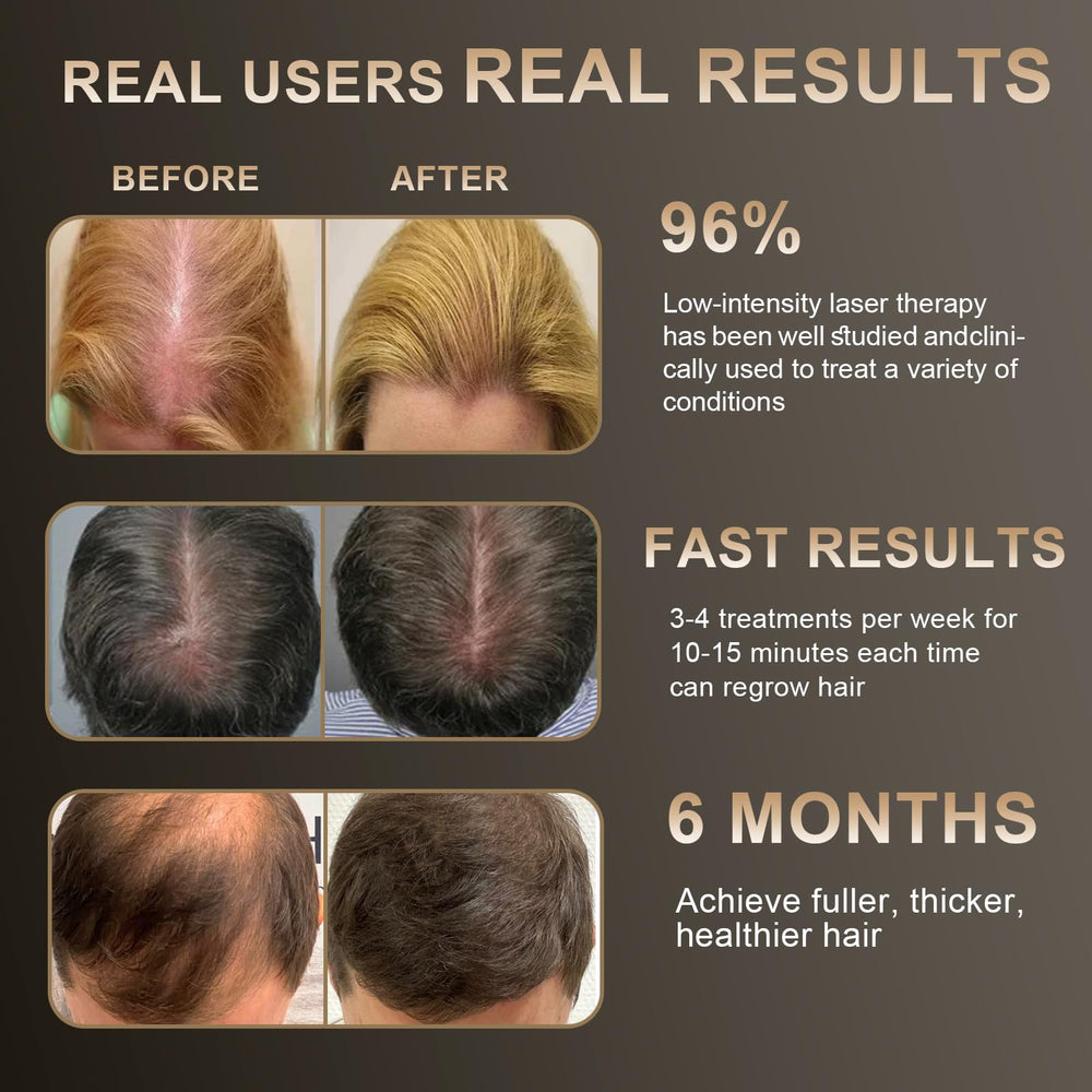 Apbier Laser Hair Growth Comb packaging box, gift-ready presentation.