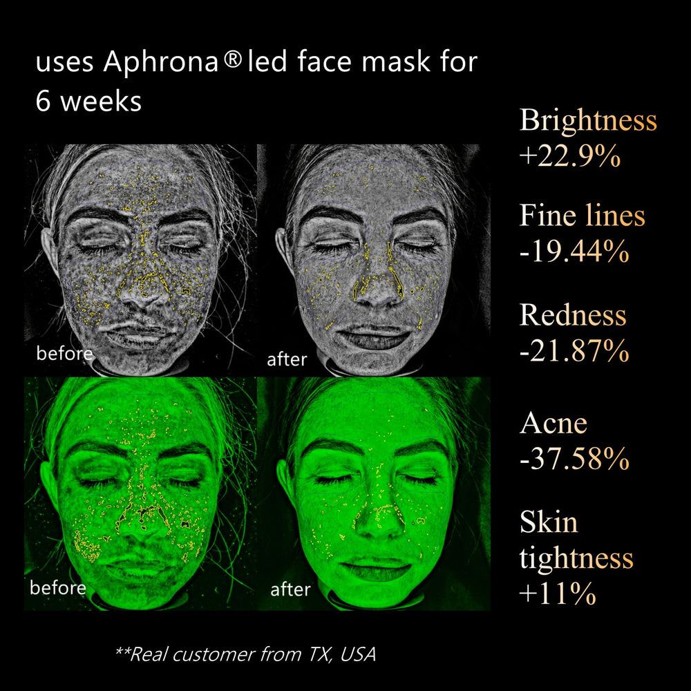 Aphrona Halo eye protection cover shielding eyes during therapy