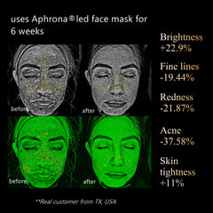Aphrona Halo eye protection cover shielding eyes during therapy