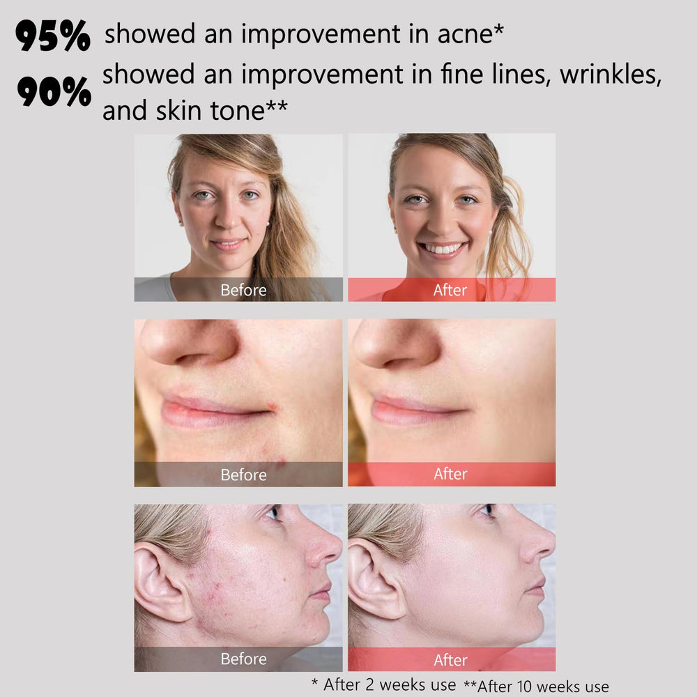Aphrona Halo treatment session in progress for a 25-minute routine