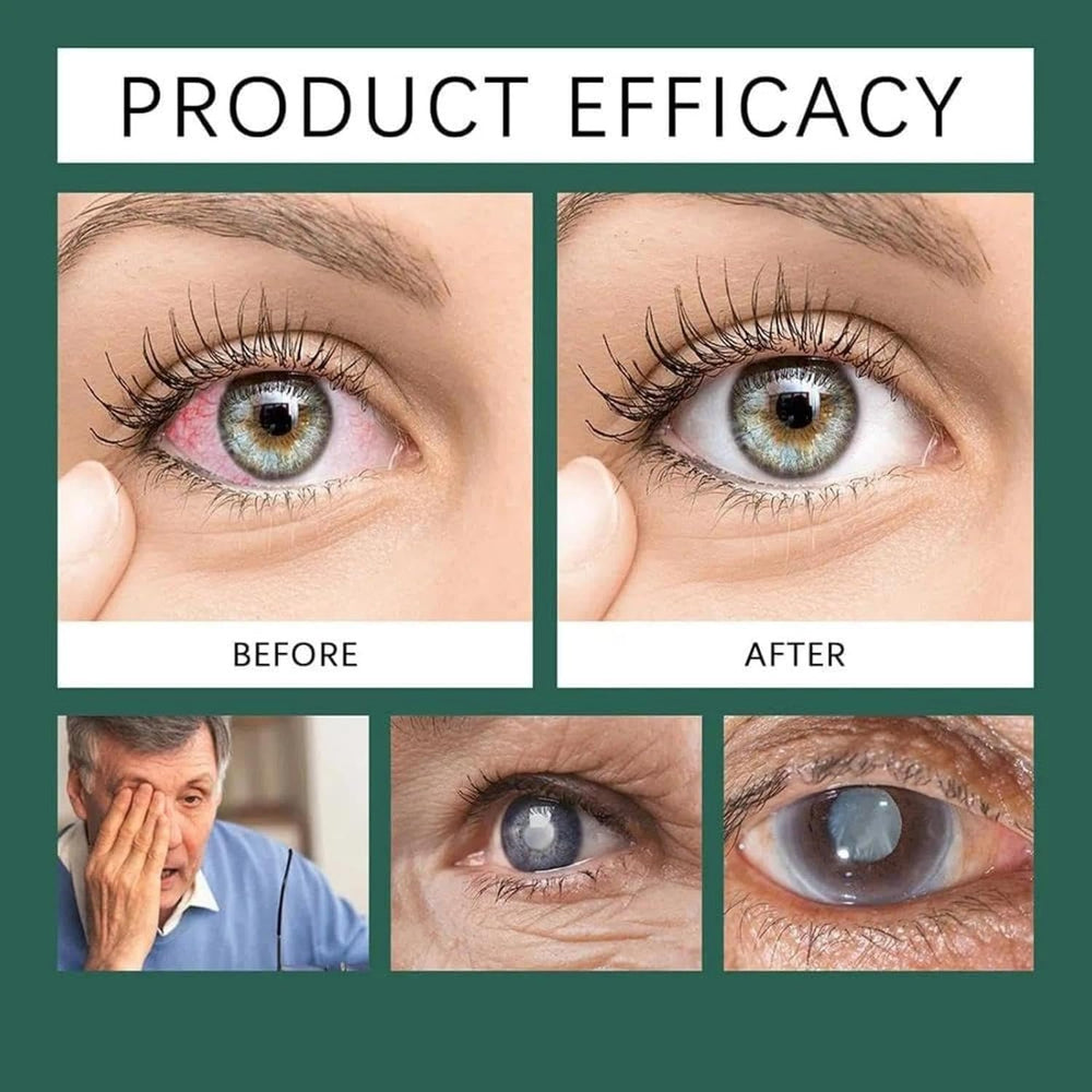 APOLO Optifusion Drops packaging highlights preservative-free daily care for sensitive eyes