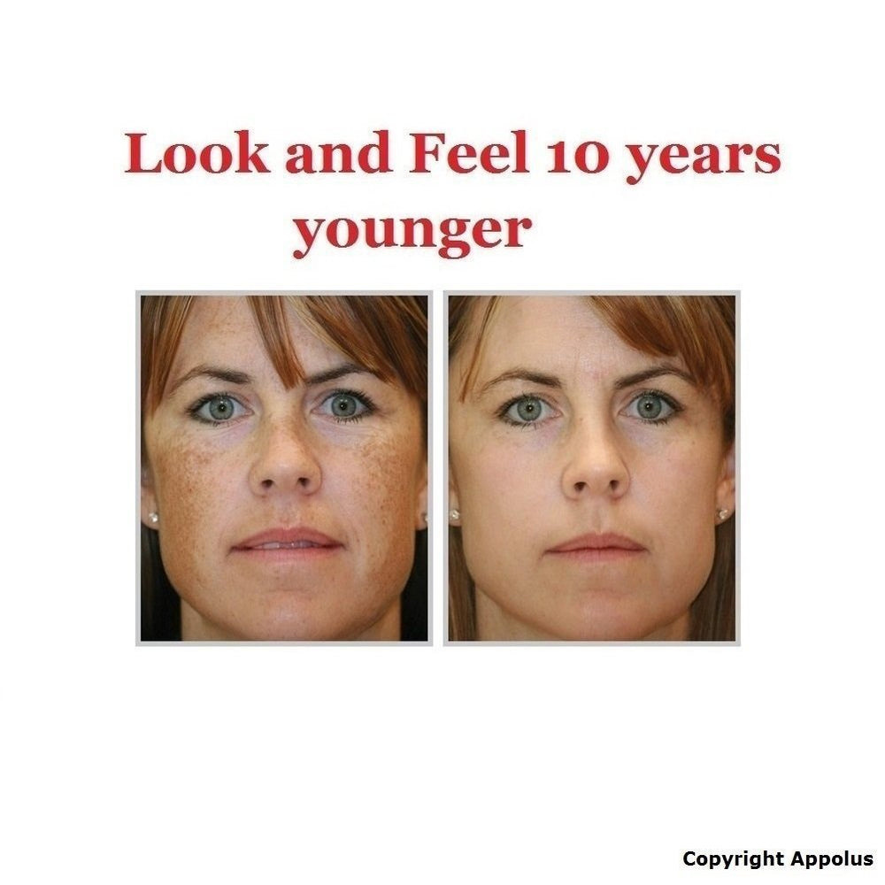 Appolus microdermabrasion at-home use in a comfortable skincare routine.