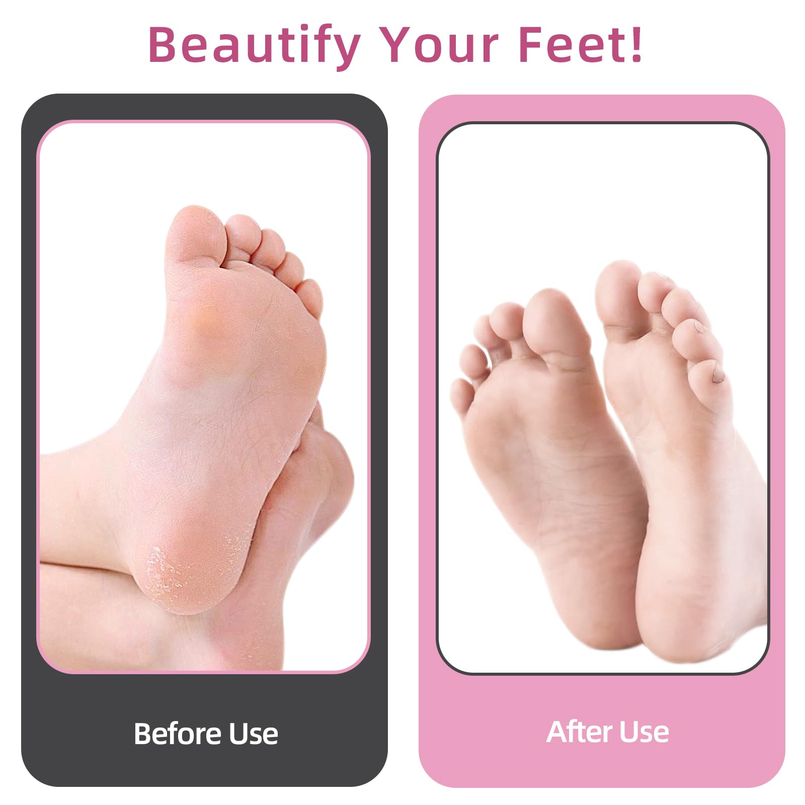 APRELM AprElm 4.8-inch longer body improves grip and comfort during use.