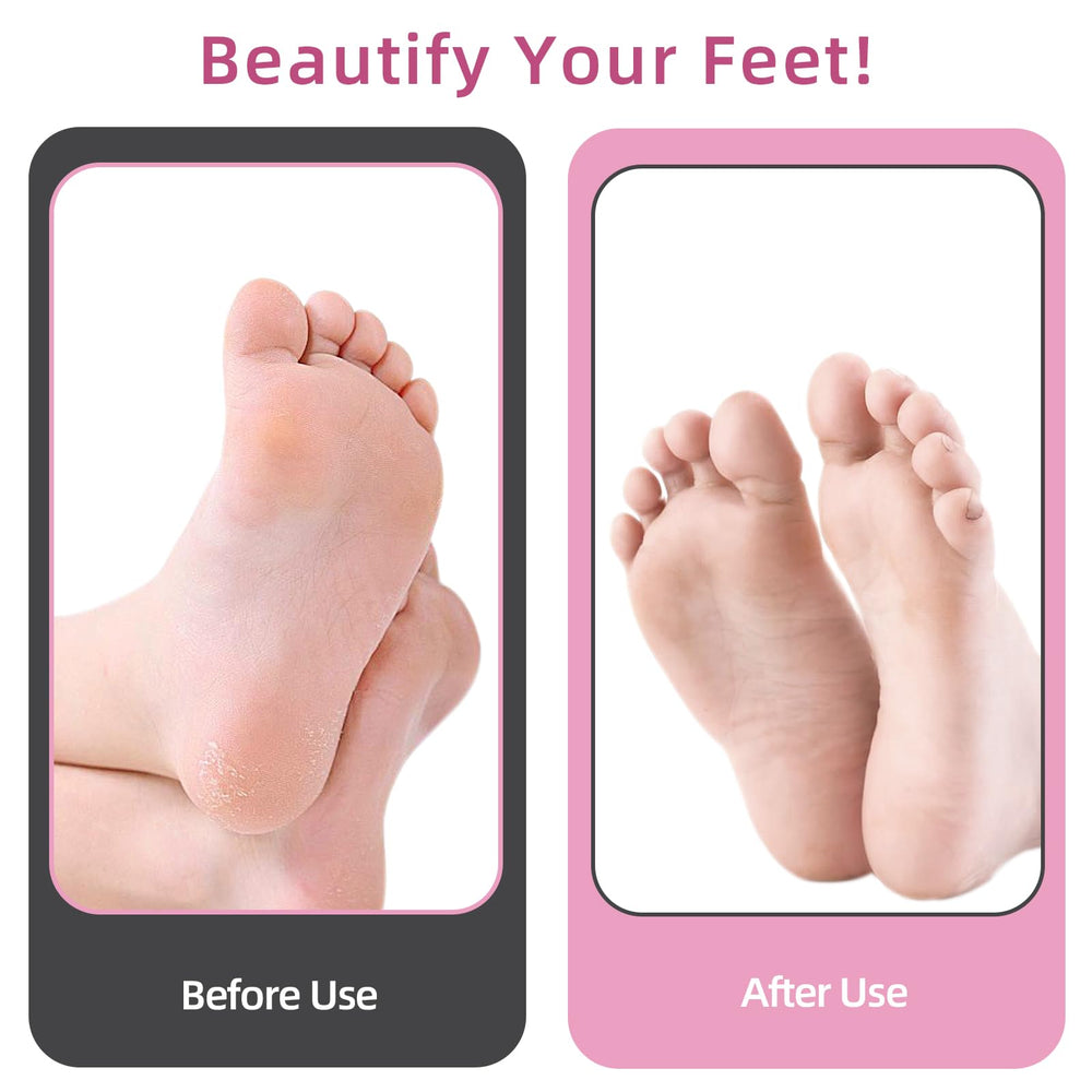 APRELM AprElm 4.8-inch longer body improves grip and comfort during use.