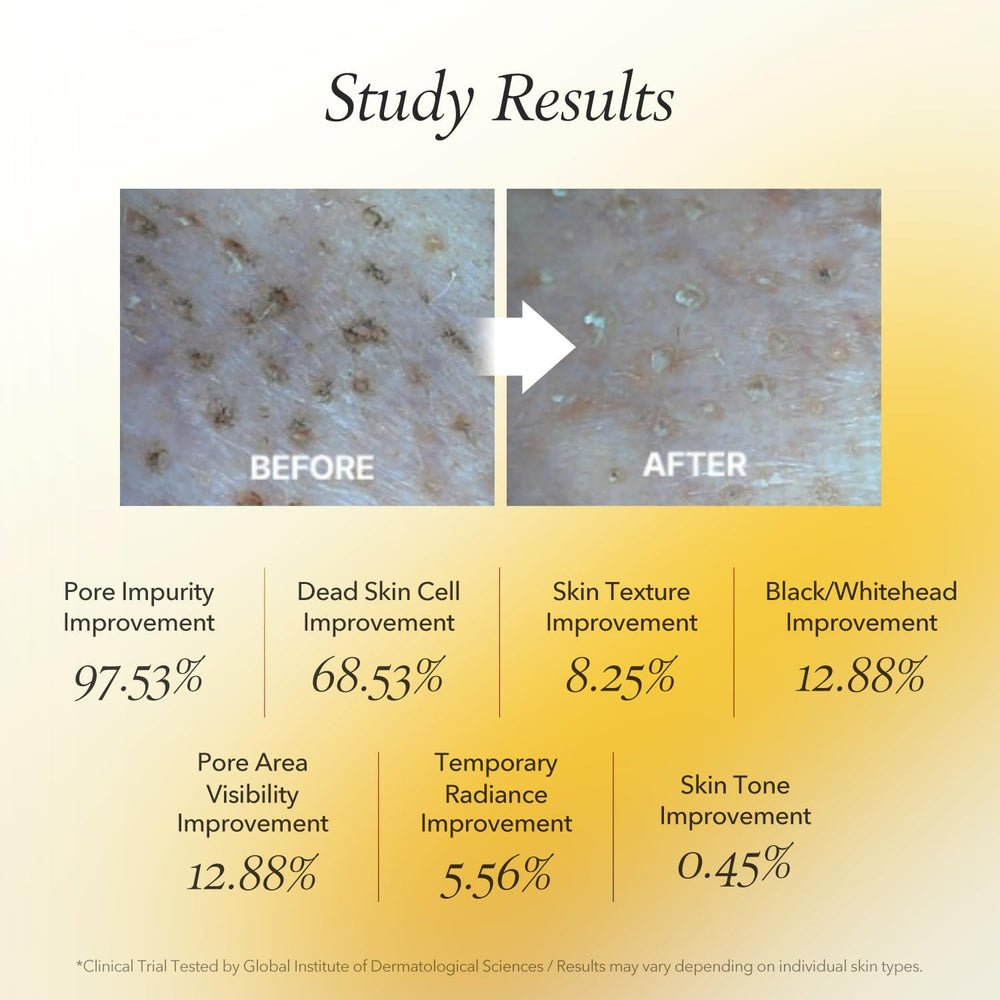APRILSKIN Calendula mask pores closeup with smoother appearance after use