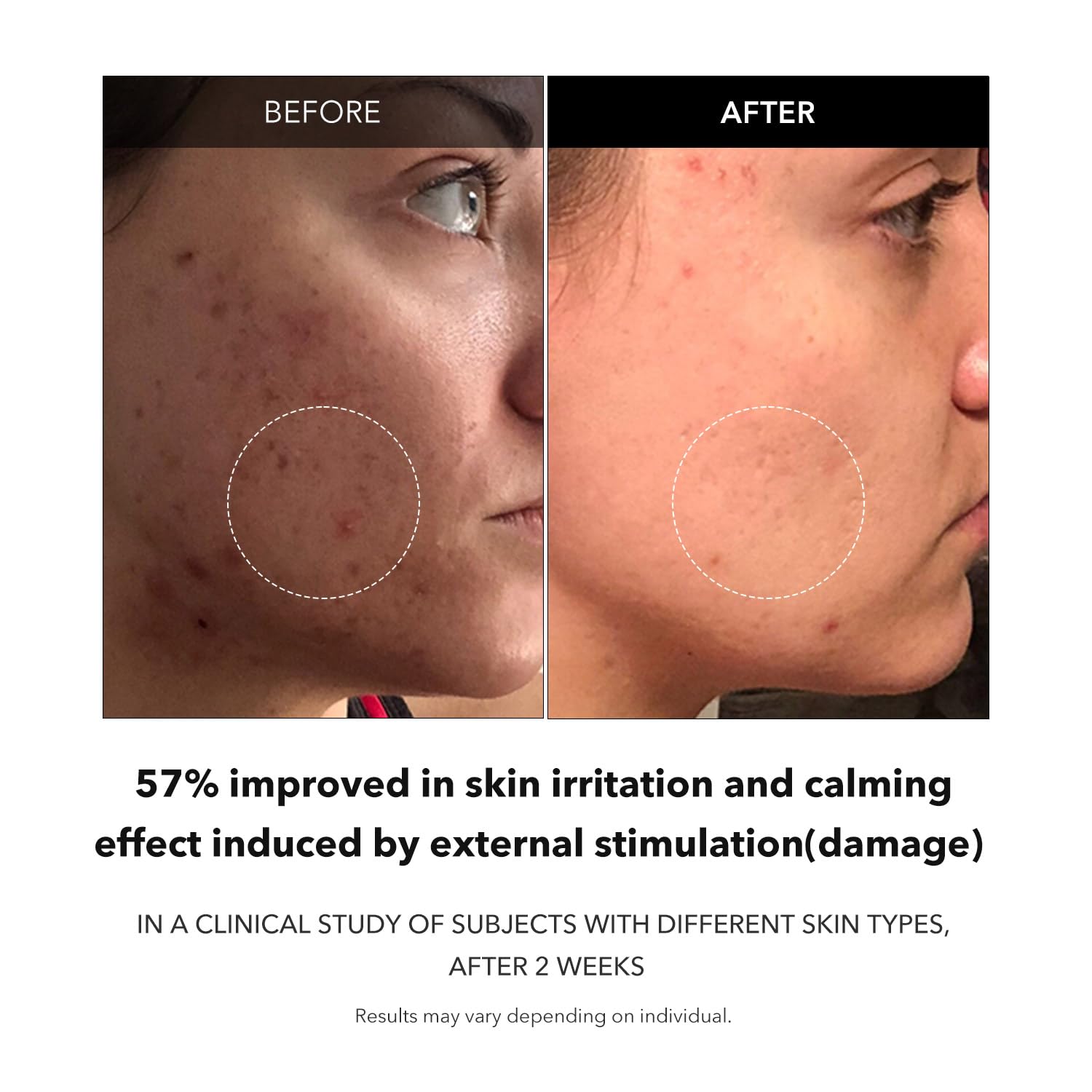 APRILSKIN Carrotene Clarifying Serum carrot ingredient closeup highlighting nourishing antioxidants.