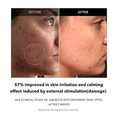 APRILSKIN Carrotene Clarifying Serum carrot ingredient closeup highlighting nourishing antioxidants.
