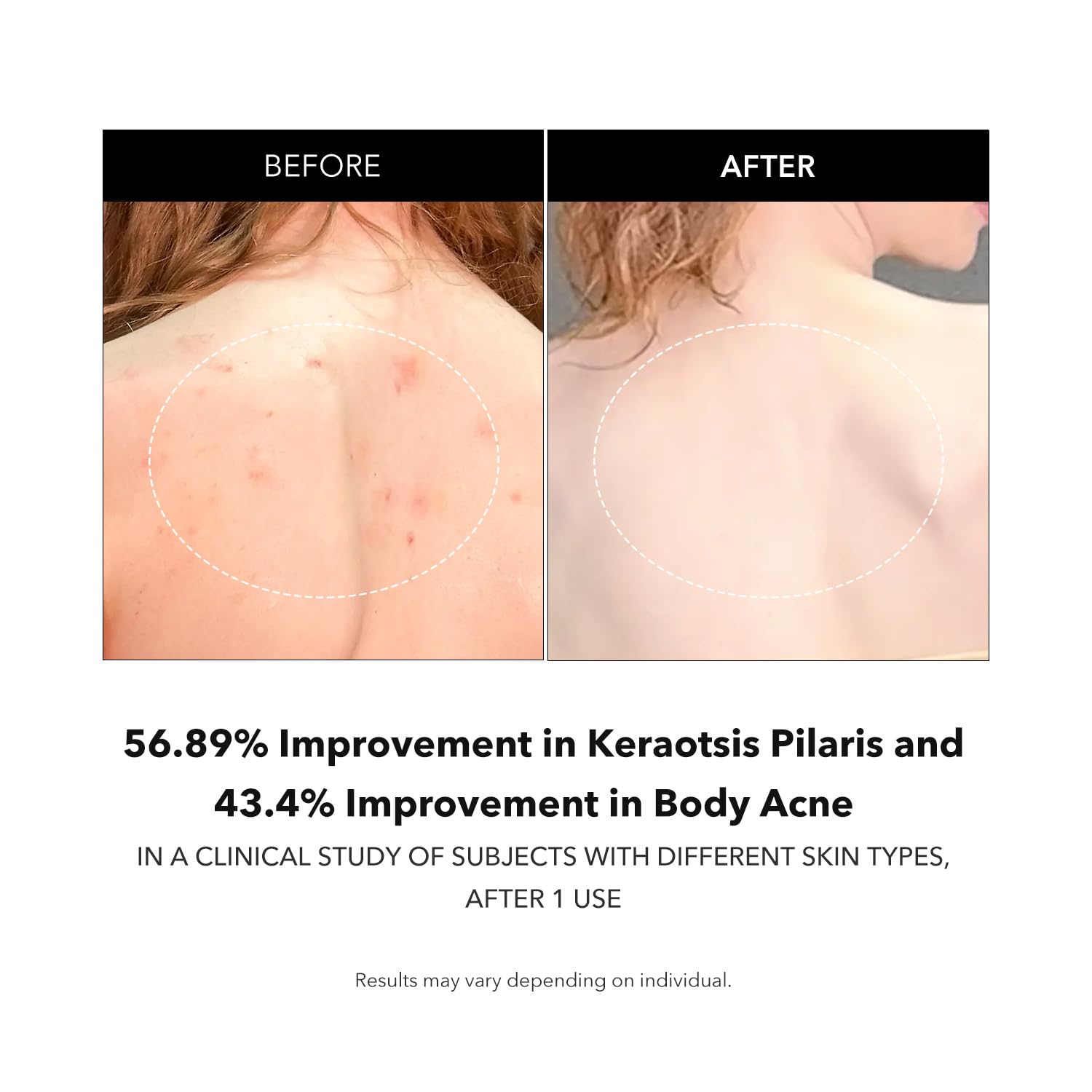 APRILSKIN Carrotene IPMP Exfoliating Body Wash being used in a shower for smooth hydrated skin