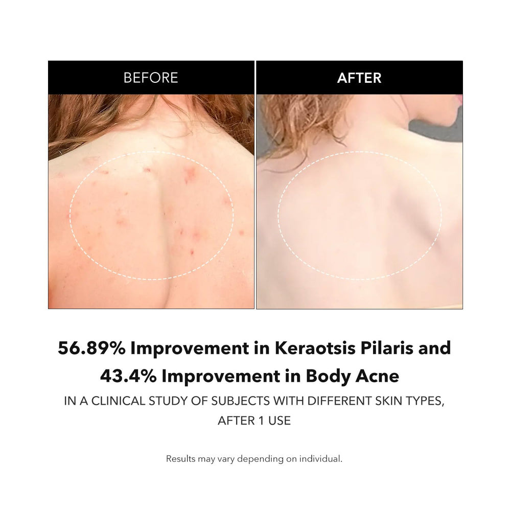 APRILSKIN Carrotene IPMP Exfoliating Body Wash being used in a shower for smooth hydrated skin
