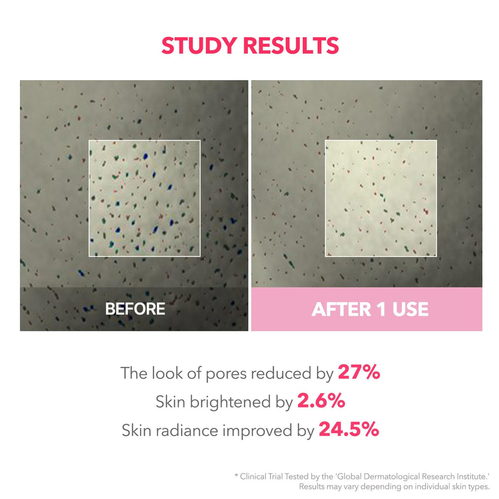 APRILSKIN morning shed peel reveals smoother skin after use