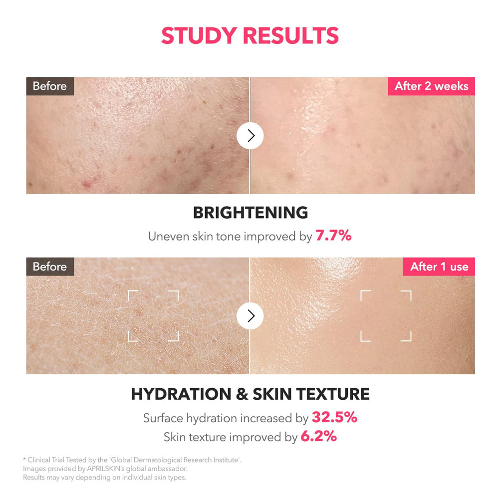 APRILSKIN TXA+Niacinamide 99 Pink Milky Toner packaging box signals premium ingredients and glass-skin focus.