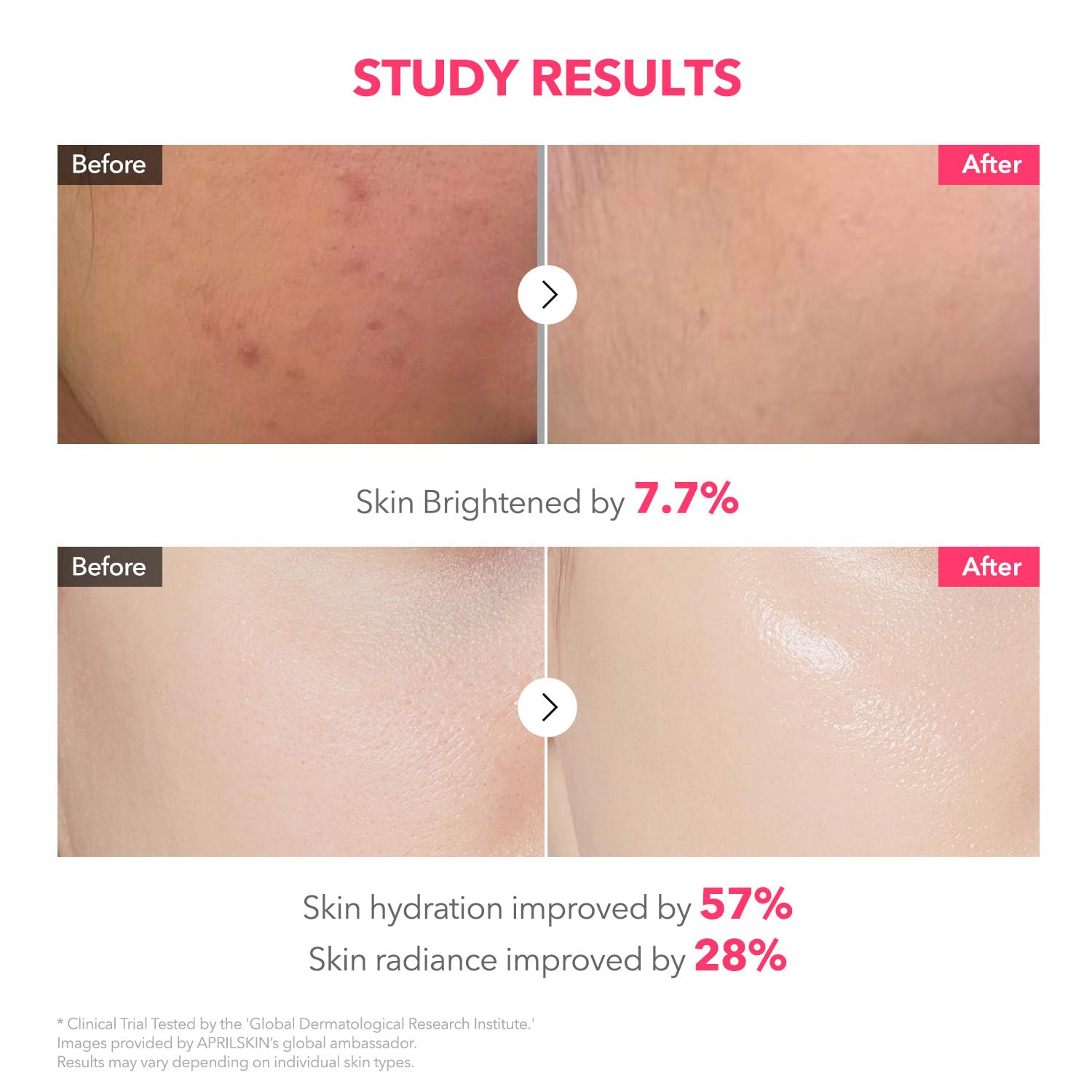 APRILSKIN TXA Pink Capsule Gel Mask night routine visual suggests overnight skin repair.