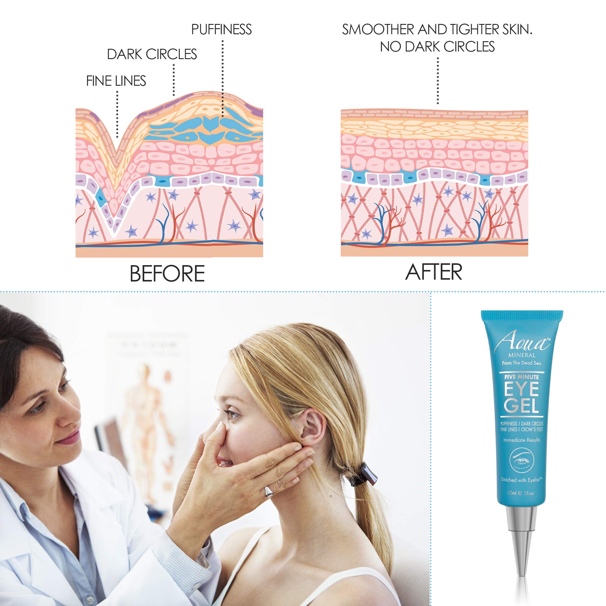 Brightening effect suggesting reduced appearance of dark circles