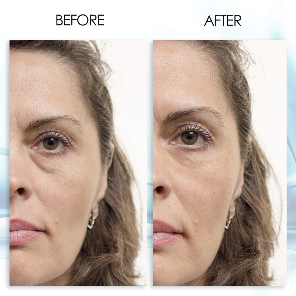 Applying Aqua Mineral Puffy Eye Gel for quick under-eye puffiness reduction