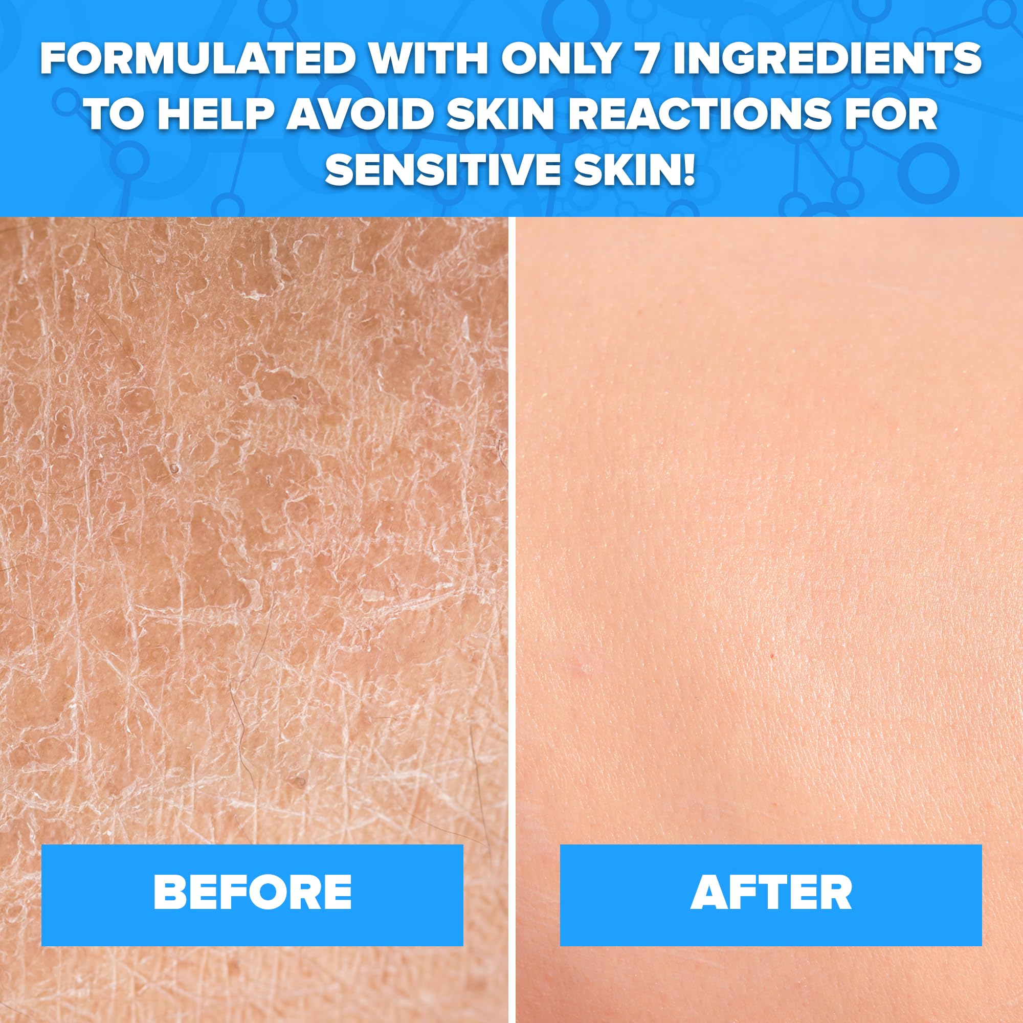 Aquanil 16 oz bottle in use—works with or without water for flexible cleansing.