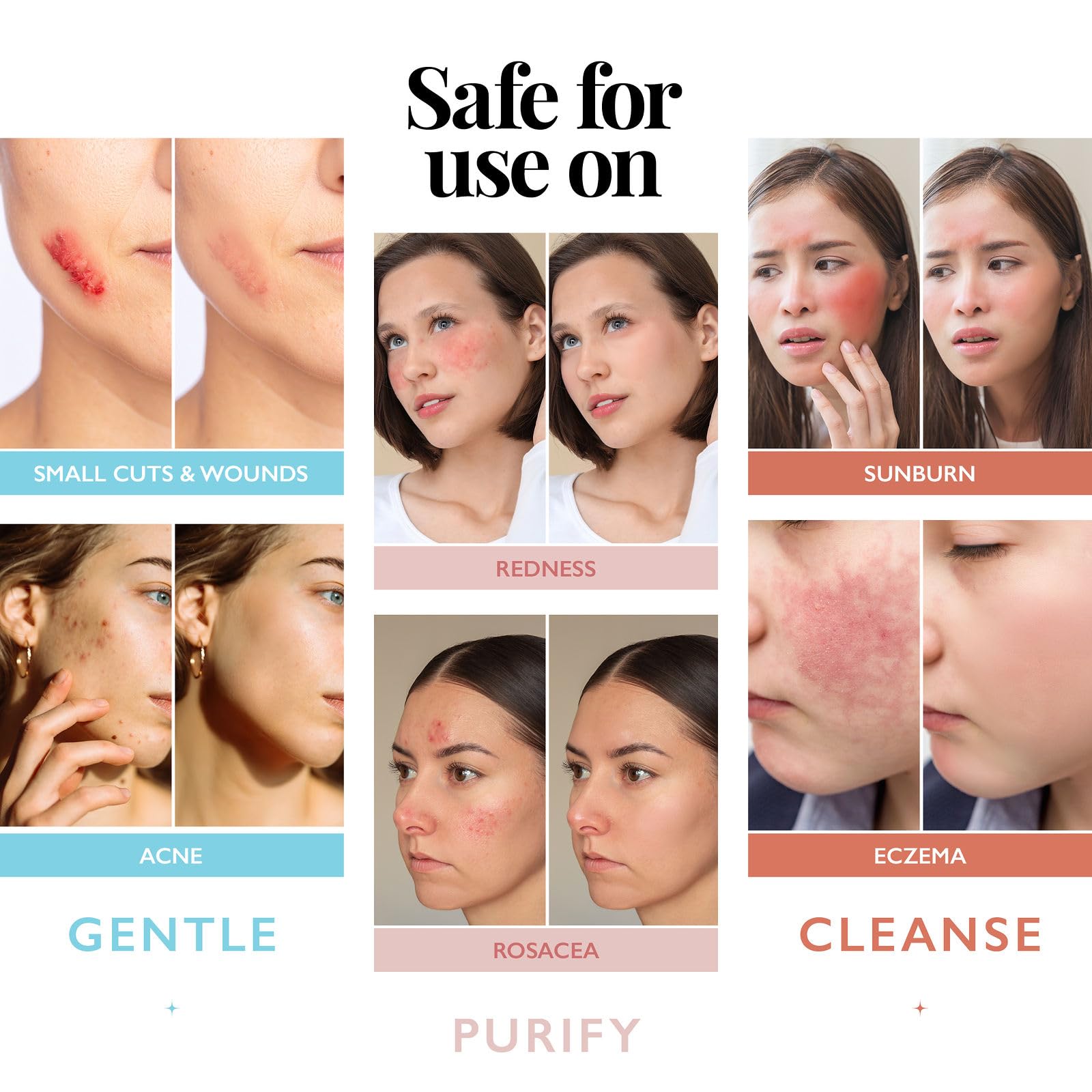 Aquia piercing-aftercare spray closeup, supports clean healing for new piercings.