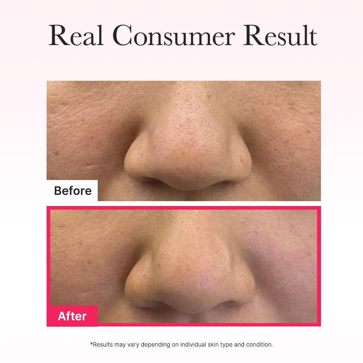 ARENCIA Red Collagen Jello Mask 5 peptides closeup reveals advanced formula benefits.
