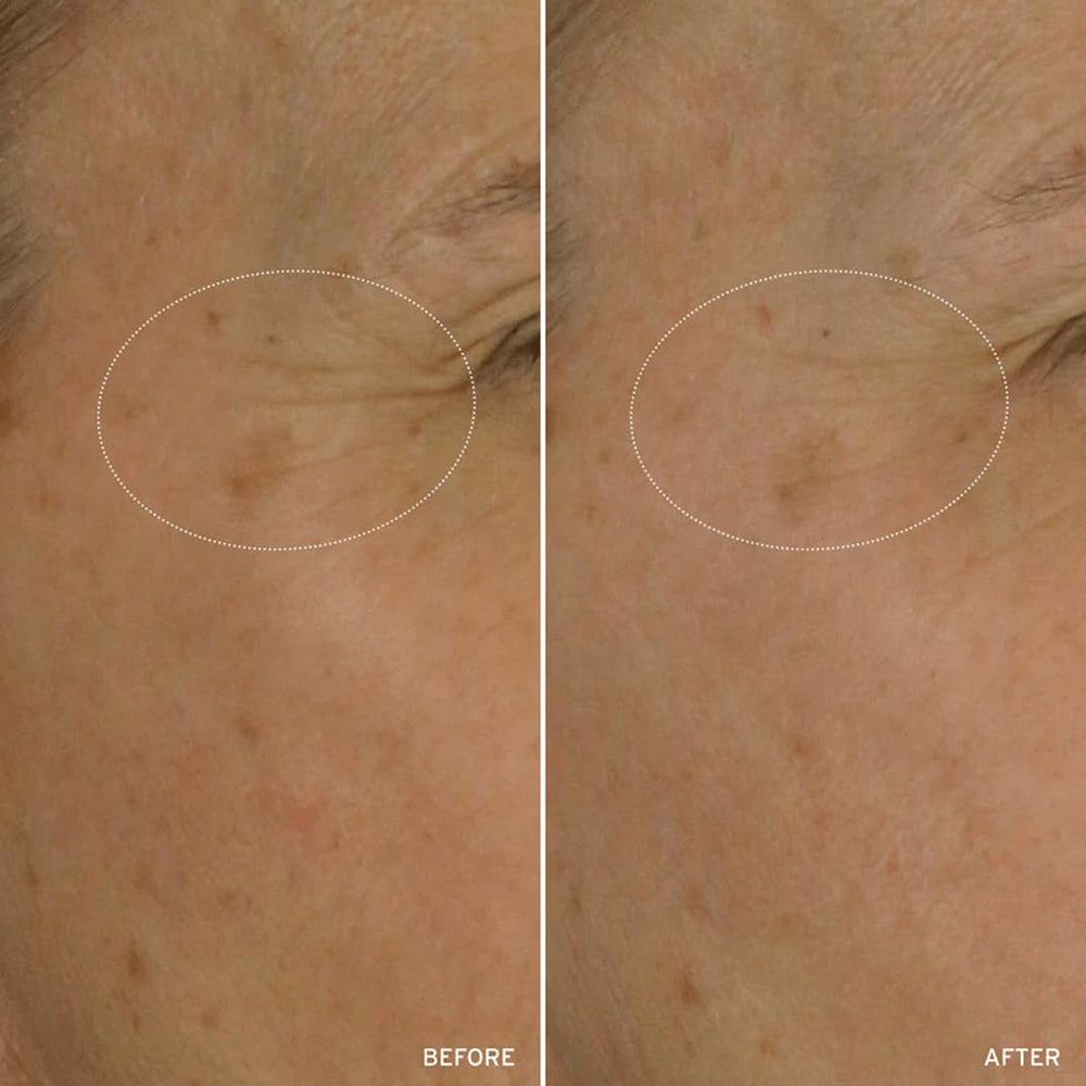 Aramore NAD+ Cell Energizing Treatment demo captures quick, absorbing application.