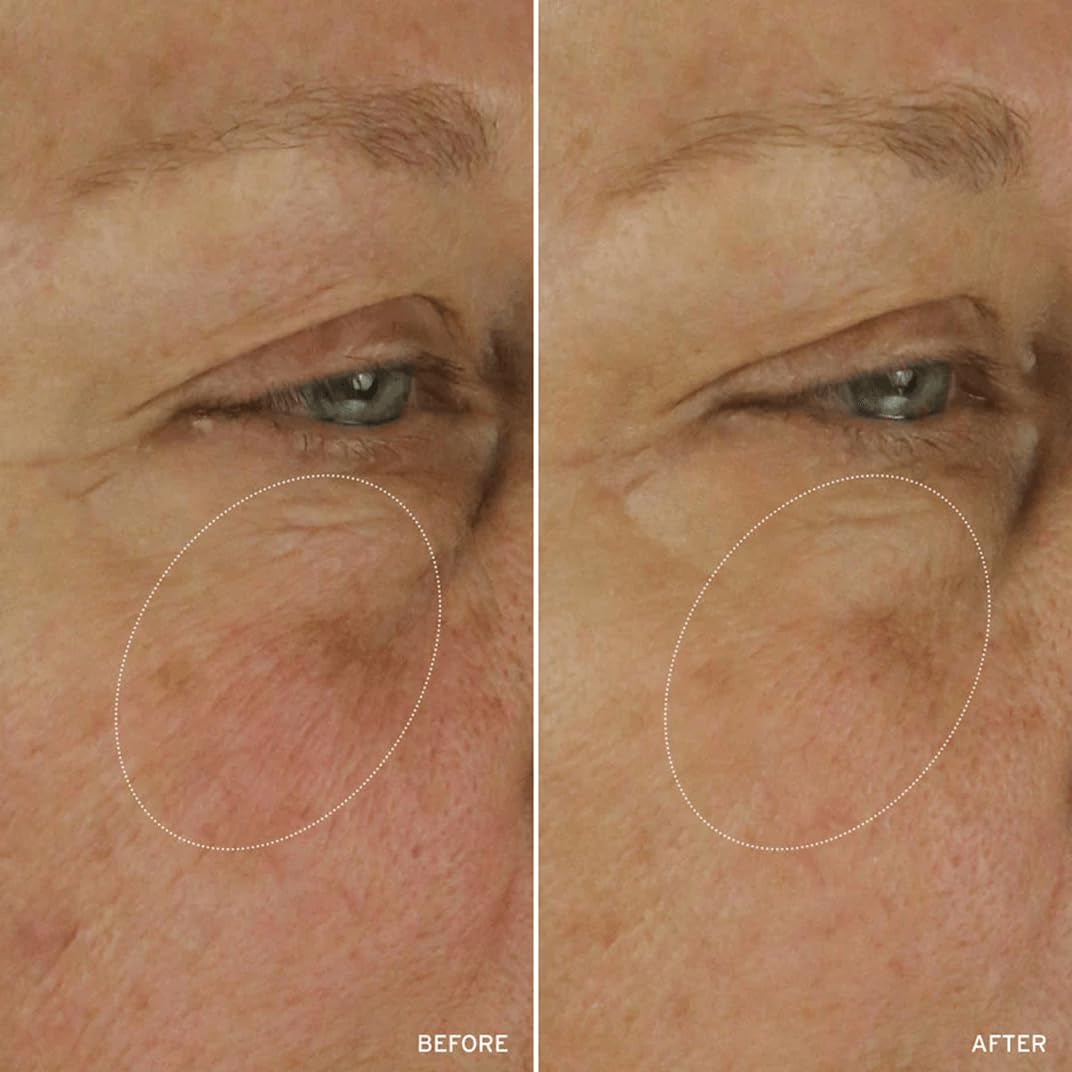 Aramore NAD+ Treatment night routine image shows easy steps to use.