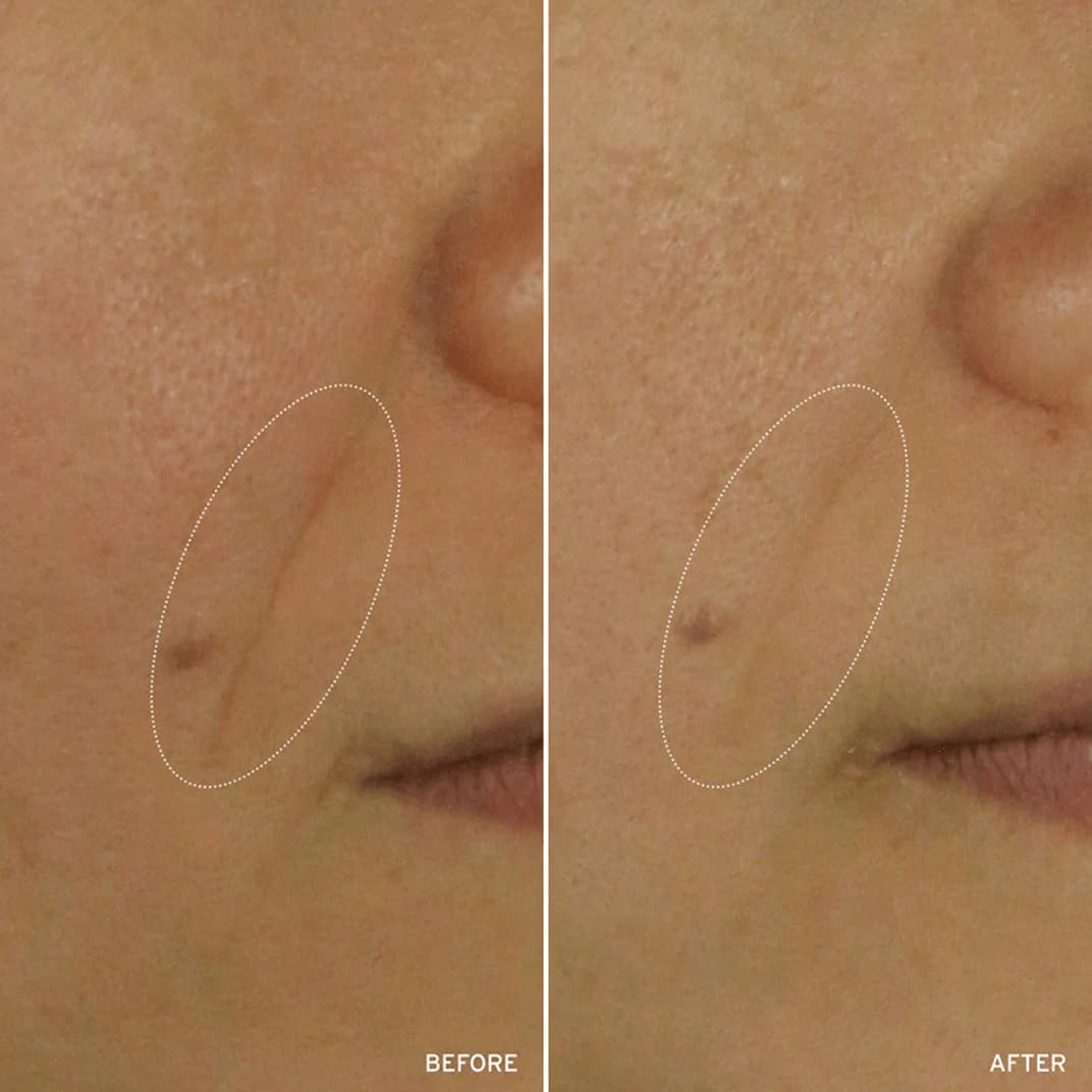 Aramore NAD+ educational visual explains how the NAD+ complex supports skin vitality.