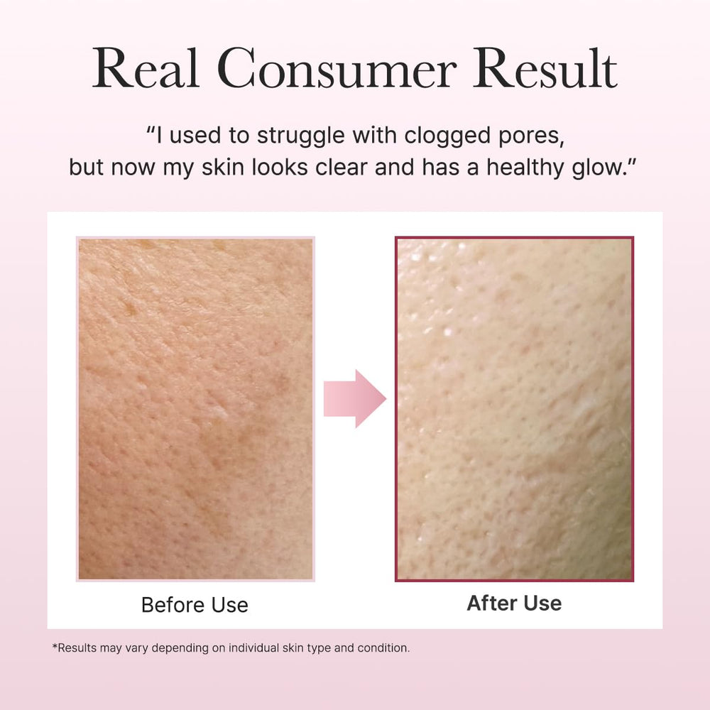 ARENCIA Fresh Rosehip Rice Mochi Cleanser in daily routine setup for calm cleanse