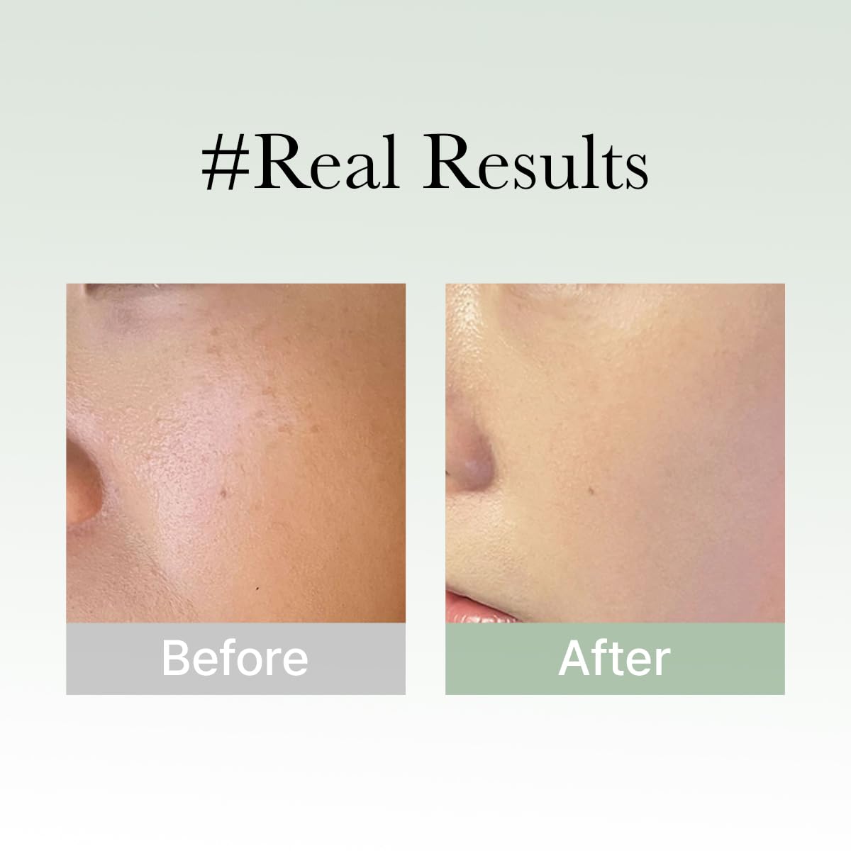 Arencia Glow Hyssop glass skin closeup suggests luminous, even-toned complexion.