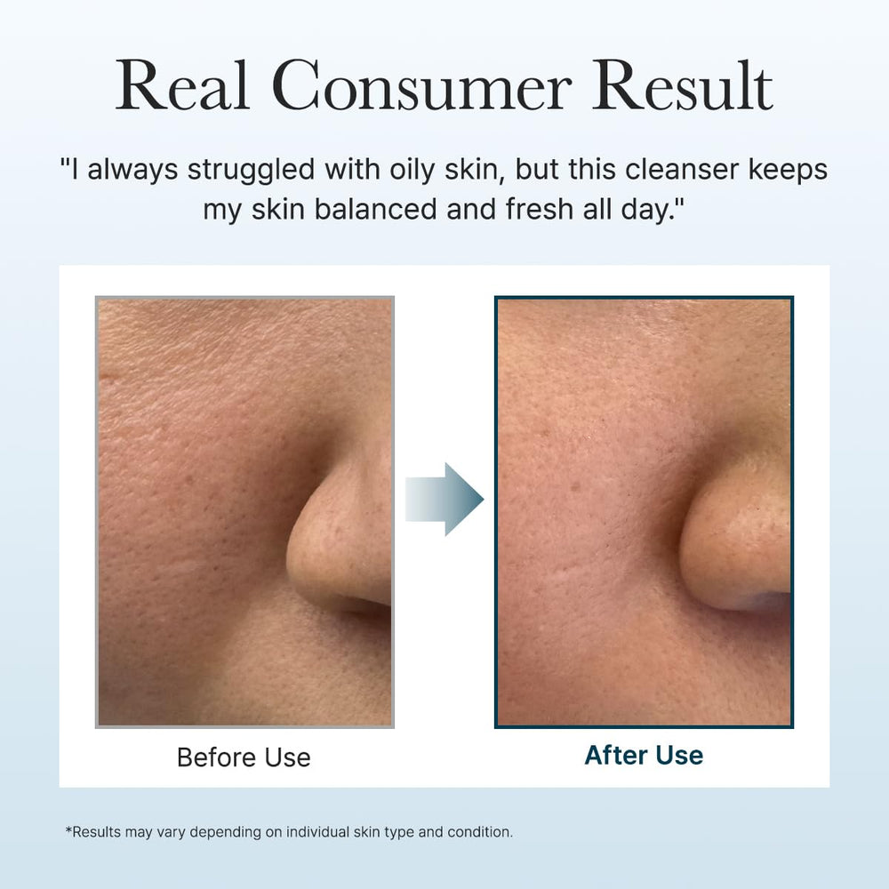 Arencia Hyssop Brightening Scrub massage on the cheek demonstrates pore cleansing