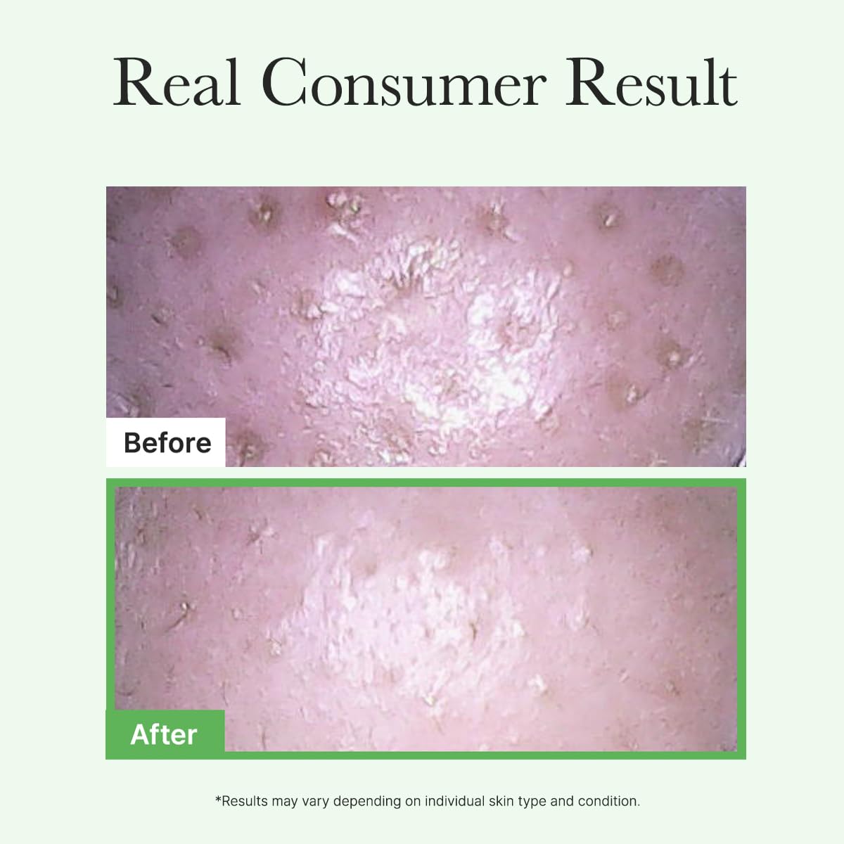 ARENCIA Pore Melt Mochi after-rinse glow on balanced skin
