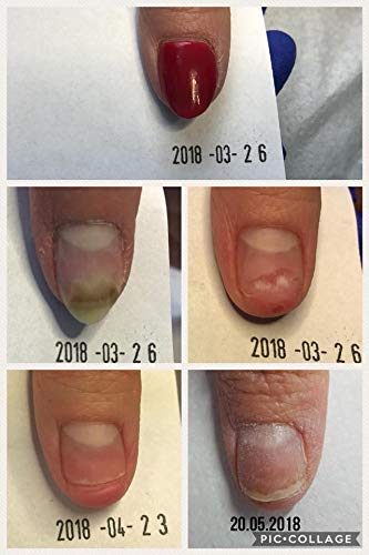 ARKADA Natura Resort Amazon TC16 in-skin application demonstrates quick absorption.