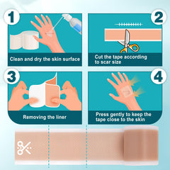 Arme scar tape applied to face-area shows precise trimming for delicate skin