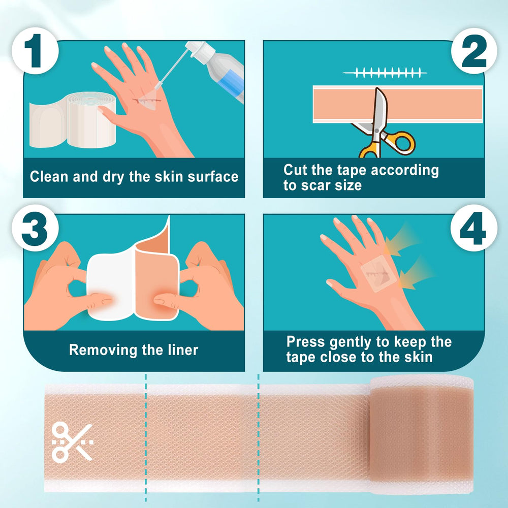 Arme silicone scar tape reusable and easy to clean with lukewarm water.